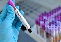 ارائه تست سرپایی کرونا در مراکز بهداشت قم