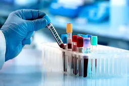 آخرین وضعیت دانشجویان مبتلا به کرونا
