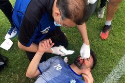 آسیب دیدگی شدید مدافع استقلال از ناحیه صورت
