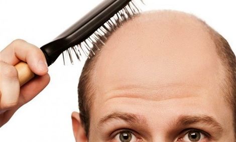 ادعای جدید محققان: احتمال ابتلا به کرونا در افراد طاس بیشتر است!