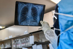 فوت اولین مادر باردار مبتلا به کرونا در شهرستان ایرانشهر