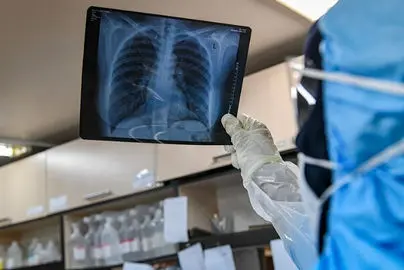 فوت اولین مادر باردار مبتلا به کرونا در شهرستان ایرانشهر