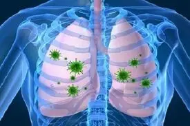 چرایی شدت درگیری ریه در افراد مختلف با کرونا مشخص نیست
