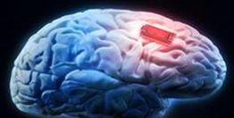 حمله ویروس کرونا به «مغز» ثابت شد