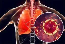 راهی برای کاهش عوارض تنفسی کرونا