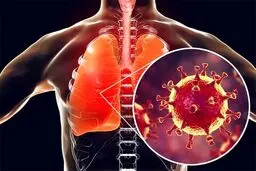 راهی برای کاهش عوارض تنفسی کرونا