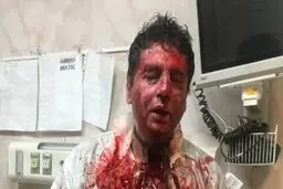 به قصد قتل آمده بودند