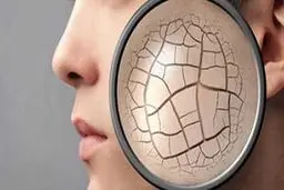 بهترین روش برای برطرف کردن خشکی پوست ناشی از مواد شوینده