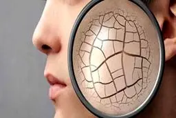 بهترین روش برای برطرف کردن خشکی پوست ناشی از مواد شوینده
