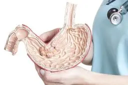 ۷ مشکل گوارشی که موجب افزایش وزن می‌شود