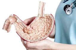 ۷ مشکل گوارشی که موجب افزایش وزن می‌شود