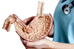۷ مشکل گوارشی که موجب افزایش وزن می‌شود