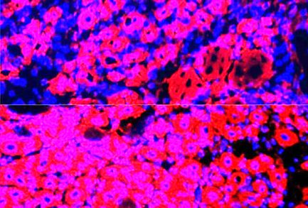 معکوس کردن روند پیری با رقیق کردن پلاسمای خون