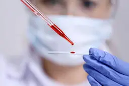 بهبودیافتگان کرونا بخوانند