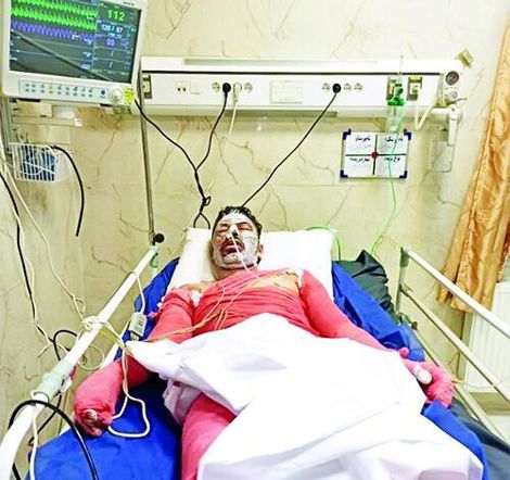 سوختن برای نسوختن