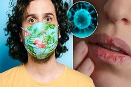 تغییرات عجیب لب‌‌ها بر اثر ابتلا به ویروس کرونا