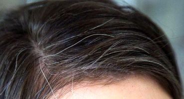 با این میو‌ه‌ها جلوی سفید شدن موی خود را بگیرید