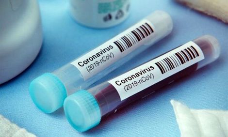 مردم خودسرانه تست کرونا ندهند