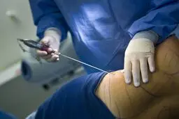 فوت یک زن بخاطر جراحی لاغری! / همسر پریسا: شکایت کرده‌ایم و تا آخرش پیگیر این ماجرا هستیم