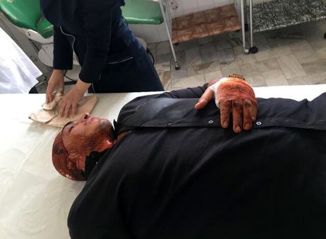 سوء قصد به جان قهرمان بوکس برای تصاحب ملک شخصی‌اش!