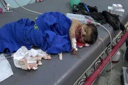 جنگنده‌های سعودی مراسم عروسی زنانه در الجوف را بمباران کردند/ افزایش کشته‌ها به ۳۵ تن