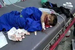 جنگنده‌های سعودی مراسم عروسی زنانه در الجوف را بمباران کردند/ افزایش کشته‌ها به ۳۵ تن