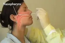 چرا جواب تست فردی که مبتلا به کروناست، منفی می‌شود؟