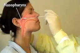 چرا جواب تست فردی که مبتلا به کروناست، منفی می‌شود؟