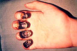 طاعون خیارکی اتفاق جدیدی نیست؛ شایعات را جدی نگیرید