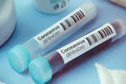 ابتلای ۲۰ درصد جمعیت ایران به کرونا چگونه اندازه‌گیری شده است؟