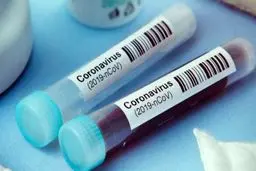 ابتلای ۲۰ درصد جمعیت ایران به کرونا چگونه اندازه‌گیری شده است؟