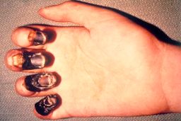 تکذیب ورود طاعون خیارکی به کشور