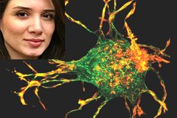 دانشمند ایرانی از راز ترمیم زخم پرده برداشت!