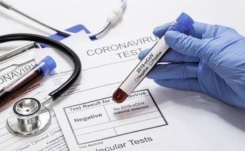 کرونا چقدر خرج روی دست خانواده‌ها می‌گذارد؟