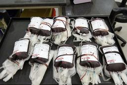 استاندار مازندران: ۲۵۰۰ بیمار خاص مازندرانی به خون نیاز دارند