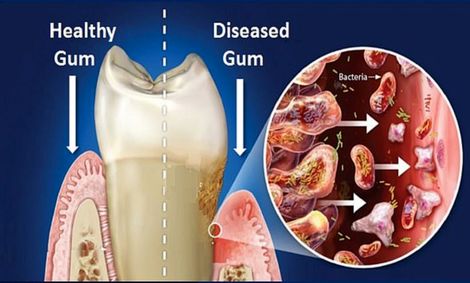 اصلی‌ترین دلیل مرگبار شدن ویروس کرونا کشف شد