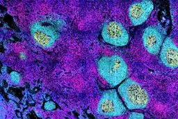 دلیل ابتلای مجدد افراد به کرونا کشف شد