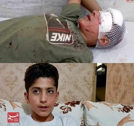 کمپین سایت رهبر انقلاب علاوه بر تامین تمامی هزینه‌های درمان چشم کولبر۱۴ ساله، یک تبلت آموزشی و کمک هزینه معاش وی را نیز تامین کرد