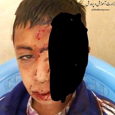 شاد، منجر به سقوط دانش آموز قاینی از بالای کوه شد