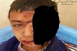شاد، منجر به سقوط دانش آموز قاینی از بالای کوه شد