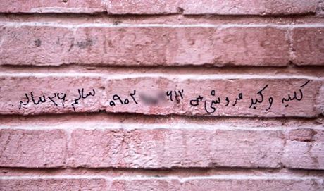 بازار خرید و فروش اعضای بدن / کلیه ۱۵۰، ‌نیمی از کبد ۲۰۰ میلیون تومان!