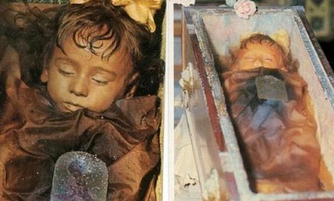 حکایت دردناک کودکی که از یک قرن پیش در خواب است