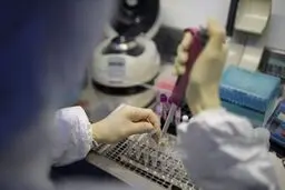 جواب تست های آنتی بادی کرونا قابل اعتماد نیست
