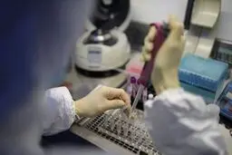 جواب تست های آنتی بادی کرونا قابل اعتماد نیست