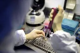 جواب تست های آنتی بادی کرونا قابل اعتماد نیست