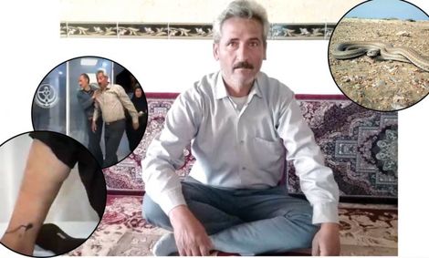 مورد عجیب مرد ۵۰ ساله خبرساز شد / راز مارگزیدگی این مرد چیست؟ + عکس