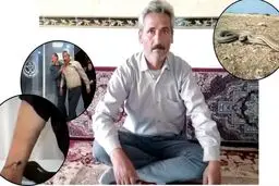 مورد عجیب مرد ۵۰ ساله خبرساز شد / راز مارگزیدگی این مرد چیست؟ + عکس