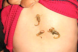 کودک دهدشتی که بدنش عقرب تولید می کند !! + تصاویر