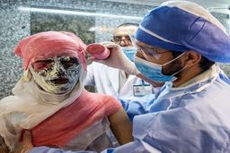 آثار تجمعات چهارشنبه‌سوری در گسترش کرونا / هزینه ۱۰میلیونی برای یک درصد درمان سوختگی