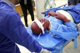 چهارشنبه‌سوری تا الان ۶ فوتی و ۳۳۱ مصدوم دارد